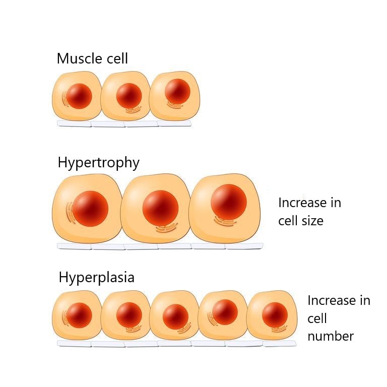 What is muscle hypertrophy